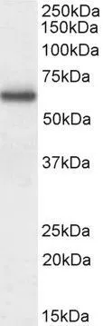 WB analysis of human lymphoblastoid using GTX14787 Coronin 1A antibody. Dilution : 0.3microg/ml Loading : 35microg protein in RIPA buffer WB analysis of human lymphoblastoid using GTX14787 Coronin 1A antibody. Dilution : 0.3microg/ml Loading : 35microg protein in RIPA buffer