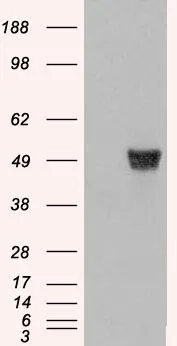 WB analysis of HEK293 overexpressing Coronin 1A (mock transfection in first lane) using GTX14787 Coronin 1A antibody.