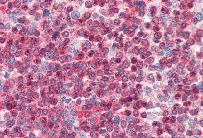 IHC-P analysis of human spleen using GTX14787 Coronin 1A antibody. Antigen retrieval : citrate buffer pH 6 Dilution : 3.75microg/ml