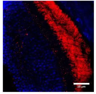 IHC analysis of mouse retina tissue (photoreceptor outer segments) using GTX14789 GUCY2F antibody. Red : Primary antibody Blue : Nuclei IHC analysis of mouse retina tissue (photoreceptor outer segments) using GTX14789 GUCY2F antibody. Red : Primary antibody Blue : Nuclei