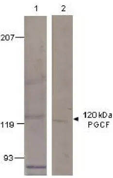 WB analysis of PGCF recombinant protein using GTX14789 GUCY2F antibody. Lane 1 : Pre-immune serum Lane 2 : Primary antibody Dilution : 1:500