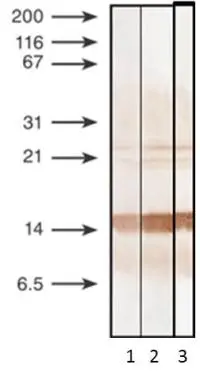 Detection of human recombinant PCT by monoclonal anti-bodies specific to N-terminal fragment of PCT after 15% SDS-PAGE in reducing conditions. Antigen loaded - 100 ng/track. 1 - GTX14816/Procalcitonin antibody [6F10] 2 - GTX14813/Procalcitonin antibody [27A3] 3 - GTX14817/Procalcitonin antibody [44d9]