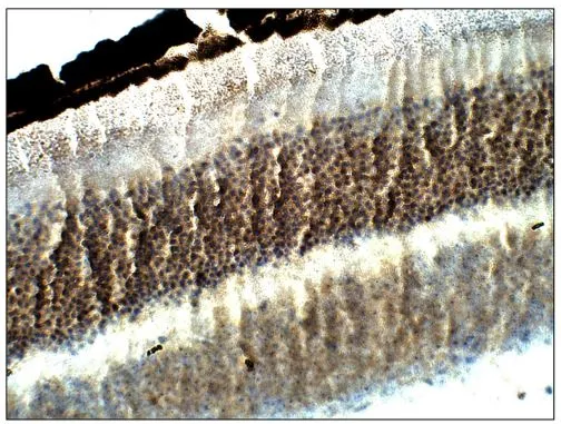 IHC-P analysis of mouse eye tissue using GTX14926 EFEMP1 antibody. Dilution : 1:50 IHC-P analysis of mouse eye tissue using GTX14926 EFEMP1 antibody. Dilution : 1:50