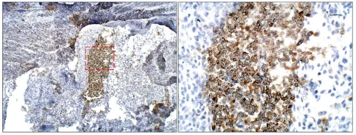 Baboon Liver-BMP2. Primary Antibody: anti-BMP2 (GTX14933) 1:100 dilution in IHC Blocking Buffer. DAB (brown) staining and Hematoxylin QS (blue) counterstain. 40X magnification on Leica DM4000. FFPE section.