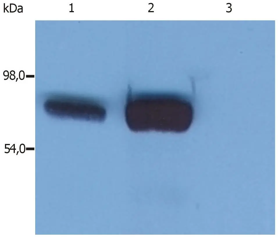 Western Blot analysis (reducing conditions) of whole cell lysate using anti-SLP76 (GTX14940).