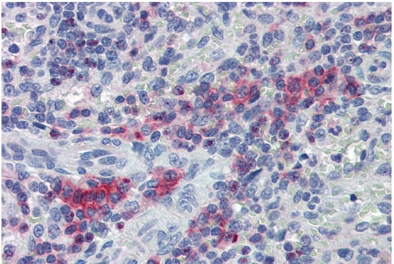 IHC-P analysis of human spleen tissue using GTX14945 LIME antibody. IHC-P analysis of human spleen tissue using GTX14945 LIME antibody.