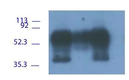 1. Frozen Raji cells lysate, immunoprecipitated with GTX24206, 2. Fresh Raji cells lysate, immunoprecipitated with GTX24206, 3. Frozen Raji cells lysate, immunoprecipitated with GTX14989, Reprobe with GTX29527. The immunoprecipitation used covalently boun 1. Frozen Raji cells lysate, immunoprecipitated with GTX24206, 2. Fresh Raji cells lysate, immunoprecipitated with GTX24206, 3. Frozen Raji cells lysate, immunoprecipitated with GTX14989, Reprobe with GTX29527. The immunoprecipitation used covalently boun