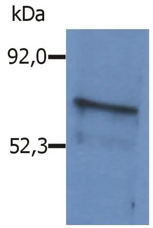 WB analysis of Sp2/0 cell lysate using GTX15008 BLNK antibody. WB analysis of Sp2/0 cell lysate using GTX15008 BLNK antibody.