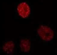 ICC/IF analysis of P388D1 cells using GTX15050 C/EBP beta antibody [1H7].