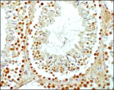 IHC-P analysis of mouse testis tissue using GTX15093 SCP3 antibody. Dilution : 1:1000