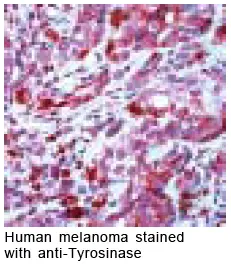 Tyrosinase antibody Tyrosinase antibody