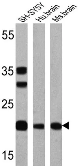 WB analysis of 25 ug of SH-SY5Y (lane 1),human brain (lane 2) and mouse brain (lane 3) using GTX15456 Presenilin 1 antibody [APS 11]. Dilution : 1:200