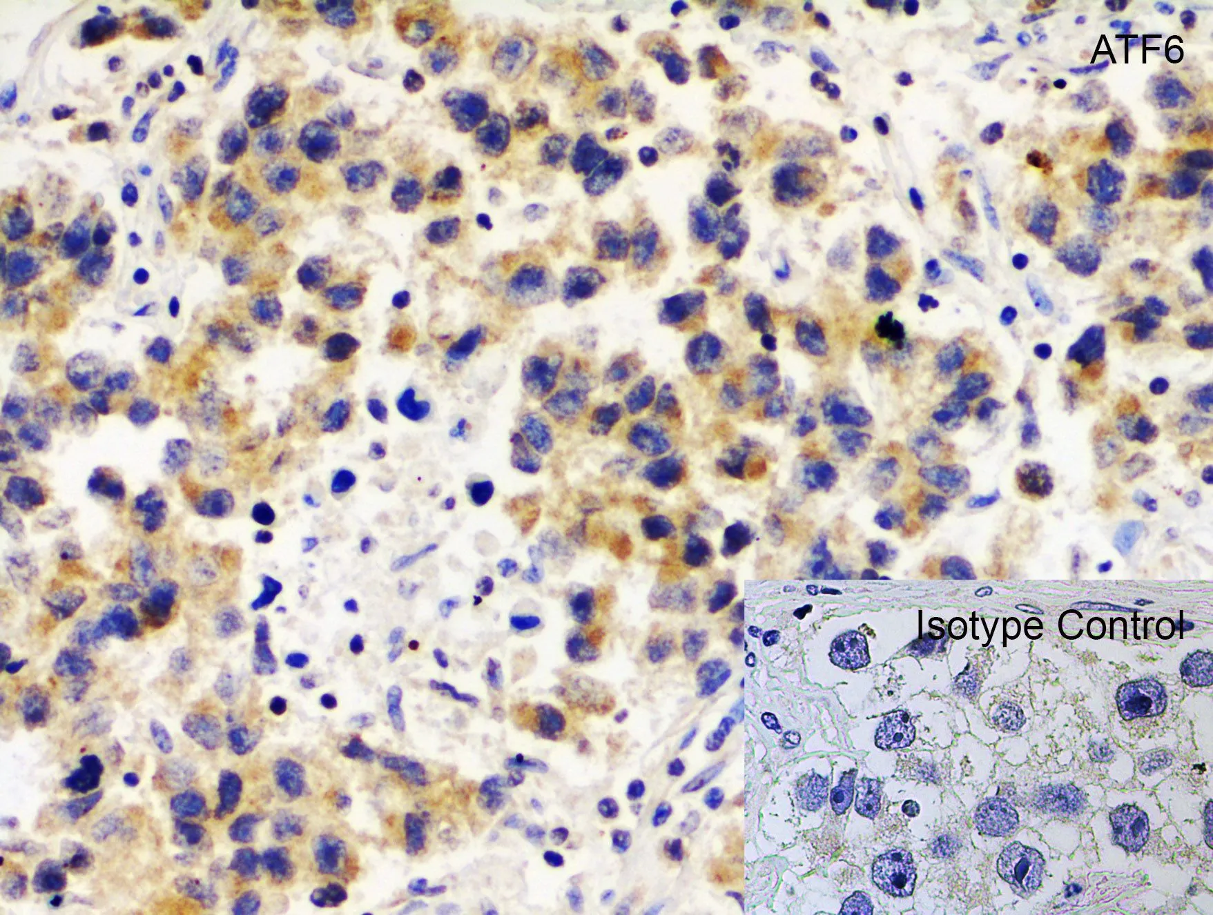 IHC-P analysis of human testis tissue using GTX15457 AFT6 antibody. Antigen retrieval : Heat mediation with citrate buffer(pH6). Dilution : 5microg/ml