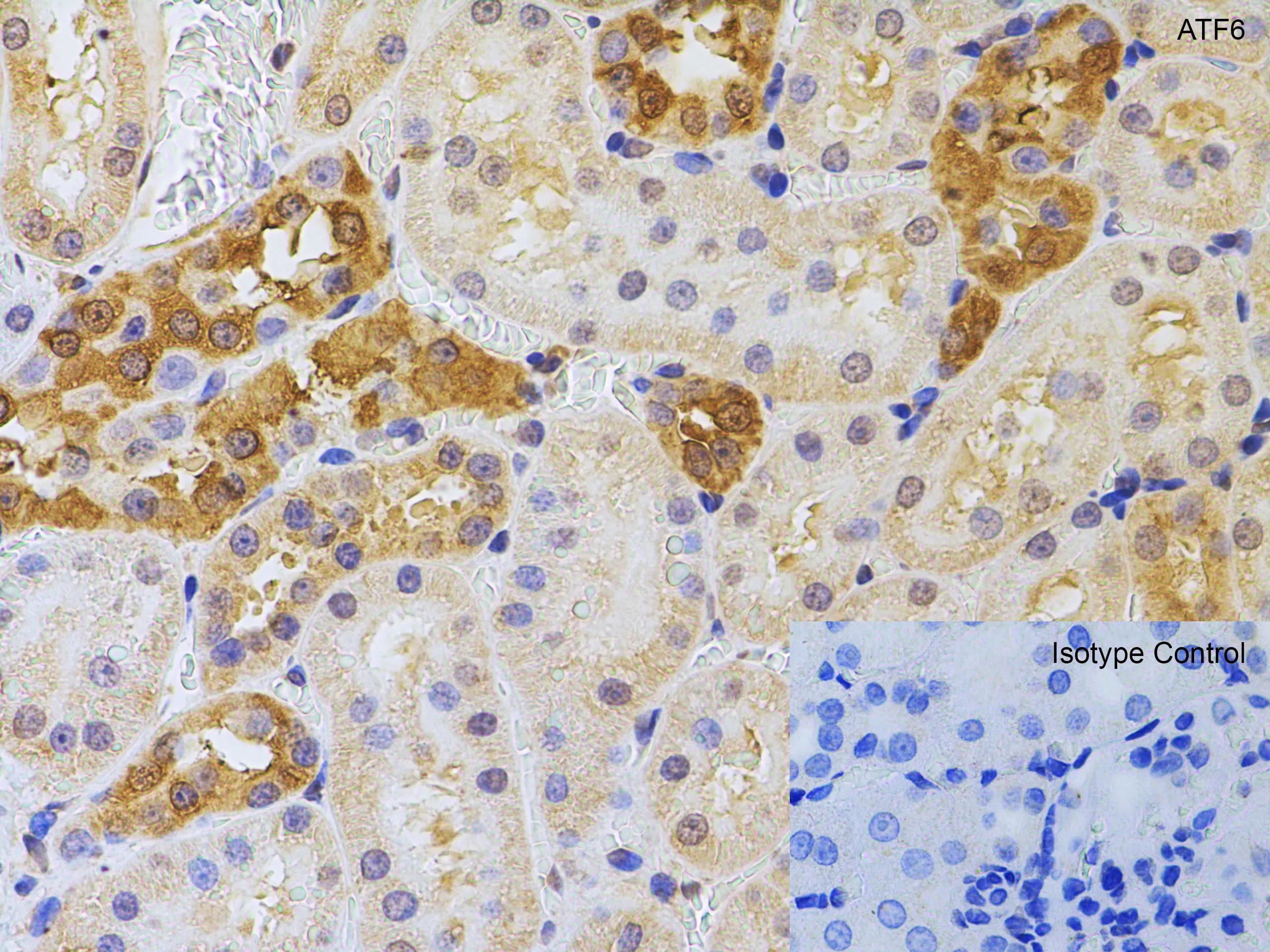 IHC-P analysis of rat kidney tissue using GTX15457 AFT6 antibody. Antigen retrieval : Heat mediation with citrate buffer(pH6). Dilution : 5microg/ml