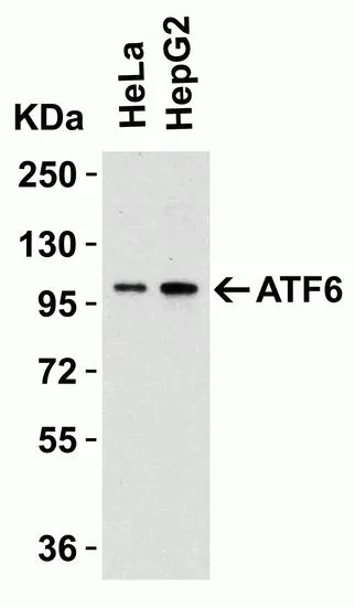 WB analysis of various whole cell lysates using GTX15457 AFT6 antibody. Dilution : 1microg/ml Loading : 15microg per lane