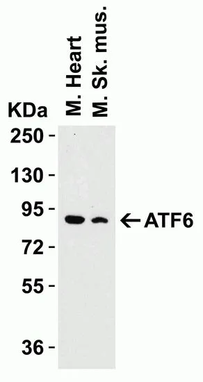 WB analysis of mouse heart and mouse skeleton muscle tissue lysates using GTX15457 AFT6 antibody. Dilution : 1microg/ml Loading : 15microg per lane