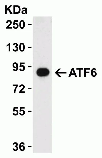 WB analysis of rat kidney tissue lysates using GTX15457 AFT6 antibody. Dilution : 1microg/ml Loading : 15microg per lane
