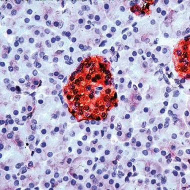 Human Pancreas stained with anti-Neuron Specific Enolase (NSE) antibody (GTX15486) Human Pancreas stained with anti-Neuron Specific Enolase (NSE) antibody (GTX15486)