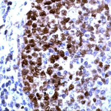 Human Tonsil stained with anti-PCNA antibody (GTX15497) Human Tonsil stained with anti-PCNA antibody (GTX15497)