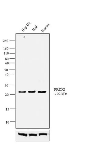 WB analysis of 25 ug of various whole cell lysates using GTX15571 PRX I antibody. Dilution : 1:1000