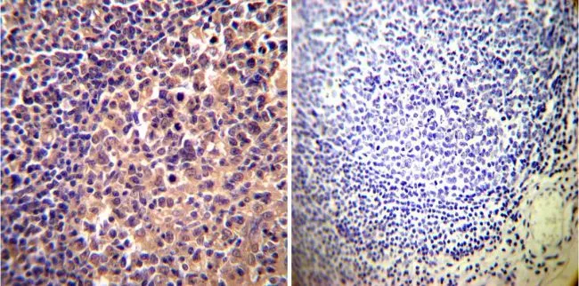 IHC-P analysis of human tonsil tissue using GTX15648 alpha Actinin 4 antibody [7H6]. Left : Primary antibody Right : Negative control without primary antibody Antigen retrieval : heat induced antigen retrieval was performed using 10mM sodium citrate (pH6.0) buffer, microwaved for 8-15 minutes Dilution : 1:200
