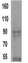 WB analysis of samples using GTX15648 alpha Actinin 4 antibody [7H6].