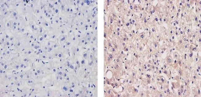 IHC-P analysis of human liver tissue using GTX15665 Apolipoprotein B antibody [F2C3]. Right : Primary antibody Left : Negative control without primary antibody Antigen retrieval : 10mM sodium citrate (pH 6.0),microwaved for 8-15 min Dilution : 1:20