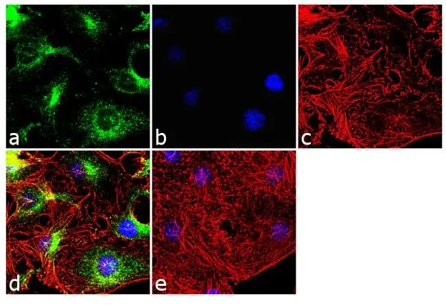 ICC/IF analysis of HeLa cells using GTX15667 Bid antibody [23F7]. Panel e is a no primary antibody control. Green : Primary antibody Blue : Nuclei Red : Actin Fixation : 4% paraformaldehyde Permeabilization : 0.1% Trito X-100 for 10 minutes Dilution : 2 microg/ml in 0.1% BSA and incubated for 3 hours at room temperature