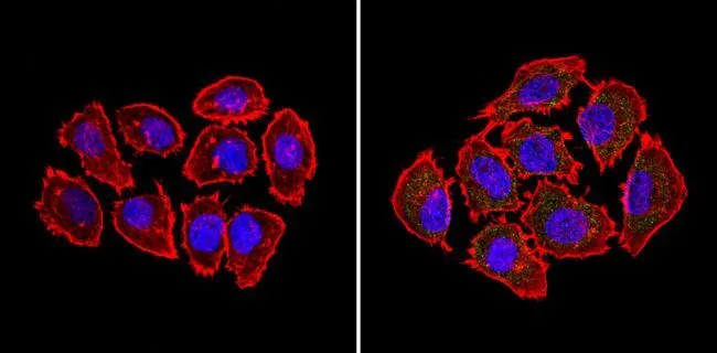 ICC/IF analysis of A549 cells using GTX15667 Bid antibody [23F7]. Cells were probed without (left) or with(right) an antibody. Green : Primary antibody Blue : Nuclei Red : Actin Fixation : Formalin Permeabilization : 0.1% Triton X-100 in TBS for 5-10 minutes Dilution : 1:20 overnight at 4oC