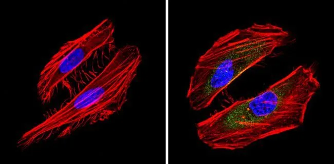 ICC/IF analysis of Hela cells using GTX15667 Bid antibody [23F7]. Cells were probed without (left) or with(right) an antibody. Green : Primary antibody Blue : Nuclei Red : Actin Fixation : Formalin Permeabilization : 0.1% Triton X-100 in TBS for 5-10 minutes Dilution : 1:20 overnight at 4oC