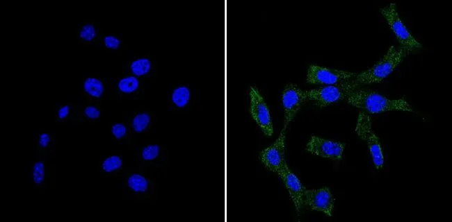 ICC/IF analysis of NIH-3T3 cells using GTX15667 Bid antibody [23F7]. Cells were probed without (left) or with(right) an antibody. Green : Primary antibody Blue : Nuclei Fixation : Formalin Permeabilization : 0.1% Triton X-100 in TBS for 5-10 minutes Dilution : 1:20 overnight at 4oC