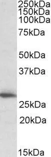 WB analysis of human heart lysate using GTX15708 CLPP antibody, C-term. Dilution : 1microg/ml Loading : 35microg protein in RIPA buffer