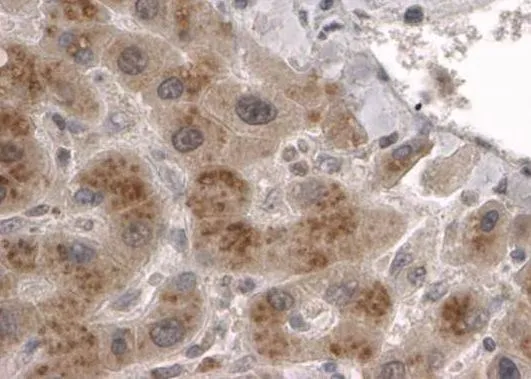IHC-P analysis of human liver using GTX15708 CLPP antibody, C-term. Antigen retrieval : citrate buffer pH 6 Dilution : 2microg/ml
