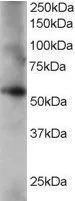 WB analysis of human lung lysate using GTX15719 Coronin 1C antibody, C-term. Dilution : 0.2microg/ml Loading : 35microg protein in RIPA buffer WB analysis of human lung lysate using GTX15719 Coronin 1C antibody, C-term. Dilution : 0.2microg/ml Loading : 35microg protein in RIPA buffer
