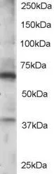 WB analysis of Jurkat lysate using GTX15720 RGS14 antibody, C-term. Dilution : 0.5microg/ml Loading : 35microg protein in RIPA buffer