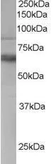 WB analysis of human PBMC lysate using GTX15724 TEM8 antibody,C-term. Dilution : 0.3ug/ml Loading : 35ug protein in RIPA buffer
