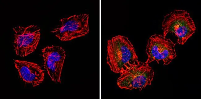 ICC/IF analysis of Hela cells using GTX15770 CD18 antibody [TS1/18]. Cells were probed without (left) or with(right) an antibody. Green : Primary antibody Blue : Nuclei Red : Actin Fixation : Formalin Permeabilization : 0.1% Triton X-100 in TBS for 5-10 minute Dilution : 1:20 overnight at 4oC