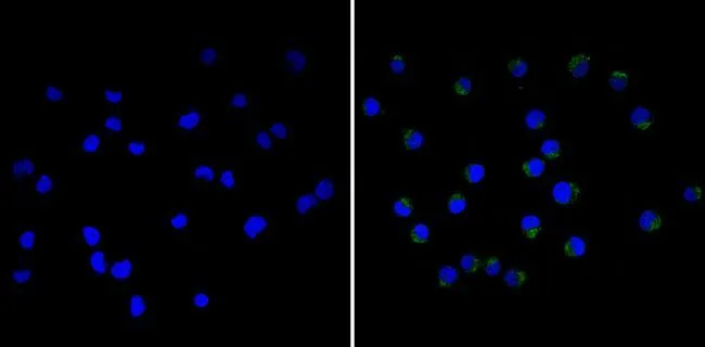 ICC/IF analysis of Jurkat cells using GTX15770 CD18 antibody [TS1/18]. Right : Primary antibody Left : Negative control without primary antibody Fixation : Formalin Permeabilization : 0.1% Triton X-100 in TBS for 5-10 minute Dilution : 1:20 overnight at 4oC