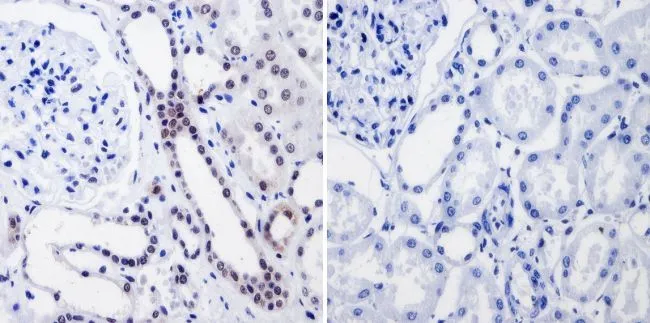 IHC-P analysis of human kidney tissue using GTX15783 RPA32 antibody [MA34]. Left : Primary antibody Right : Negative control without primary antibody Antigen retrieval : heat induced antigen retrieval was performed using 10mM sodium citrate (pH6.0) buffer, microwaved for 8-15 minutes Dilution : 1:20