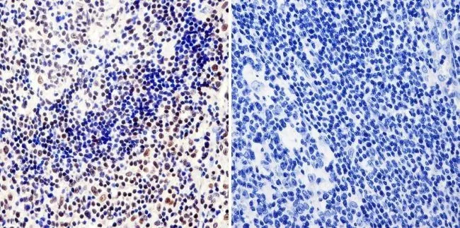 IHC-P analysis of human tonsil tissue using GTX15783 RPA32 antibody [MA34]. Left : Primary antibody Right : Negative control without primary antibody Antigen retrieval : heat induced antigen retrieval was performed using 10mM sodium citrate (pH6.0) buffer, microwaved for 8-15 minutes Dilution : 1:20