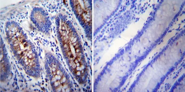 IHC-P analysis of human colon tissue using GTX15794 gamma Tubulin antibody [4D11]. Left : Primary antibody Right : Negative control without primary antibody Antigen retrieval : heat induced antigen retrieval was performed using 10mM sodium citrate (pH6.0) buffer, microwaved for 8-15 minutes Dilution : 1:200