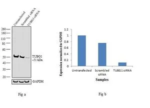 WB analysis of gamma tubulin knockdown HeLa cells (lane 3), scrambled siRNA transfected cells (lane 2) and untransfected cells (lane 1) using GTX15794 gamma Tubulin antibody [4D11]. Dilution : 1:1000