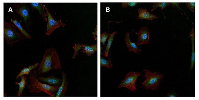 ICC/IF analysis of HeLa (A) and U2-OS cells (B) using GTX15794 gamma Tubulin antibody [4D11]. Green : Primary antibody Blue : Nuclei Red : Actin Fixation : Formalin Permeabilization : 0.1% Triton X-100 in TBS for 10 minutes Dilution : 1:50 for at least 1 hour at room temperature