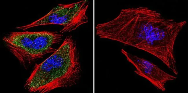 ICC/IF analysis of A2058 Cells using GTX15796 PRC1 antibody [16F2]. Cells were probed without (right) or with(left) an antibody. Green : Primary antibody Blue : Nuclei Red : Actin Fixation : formaldehyde Dilution : 1:100 overnight at 4 oC