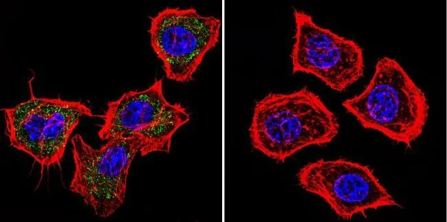 ICC/IF analysis of HeLa cells using GTX15796 PRC1 antibody [16F2]. Cells were probed without (right) or with(left) an antibody. Green : Primary antibody Blue : Nuclei Red : Actin Fixation : formaldehyde Dilution : 1:100 overnight at 4 oC