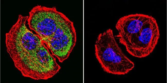 ICC/IF analysis of U251 cells using GTX15796 PRC1 antibody [16F2]. Cells were probed without (right) or with(left) an antibody. Green : Primary antibody Blue : Nuclei Red : Actin Fixation : formaldehyde Dilution : 1:20 overnight at 4oC