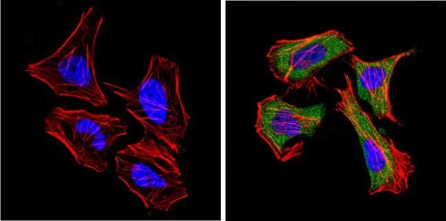 ICC/IF analysis of Hela cells using GTX15833 CD26 antibody [236.3]. Cells were probed without (left) or with(right) an antibody. Green : Primary antibody Blue : Nuclei Red : Actin Fixation : Formalin Permeabilization : 0.1% Triton X-100 in TBS for 5-10 minute Dilution : 1:20 overnight at 4oC