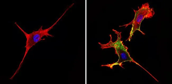 ICC/IF analysis of NIH-3T3 cells using GTX15834 CD44 antibody [1M7.8.1]. Cells were probed without (left) or with(right) an antibody. Green : Primary antibody Blue : Nuclei Red : Actin Fixation : Formalin Permeabilization : 0.1% Triton X-100 in TBS for 5-10 minute Dilution : 1:20 overnight at 4oC