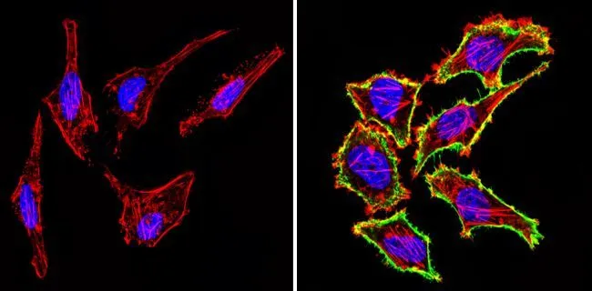 ICC/IF analysis of Hela cells using GTX15834 CD44 antibody [1M7.8.1]. Cells were probed without (left) or with(right) an antibody. Green : Primary antibody Blue : Nuclei Red : Actin Fixation : Formalin Permeabilization : 0.1% Triton X-100 in TBS for 5-10 minute Dilution : 1:20 overnight at 4oC