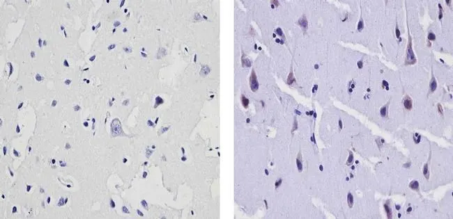 ICC/IF analysis of C6 cells using GTX15835 Synaptojanin 1 antibody [AC1]. Cells were probed without (left) or with(right) an antibody.